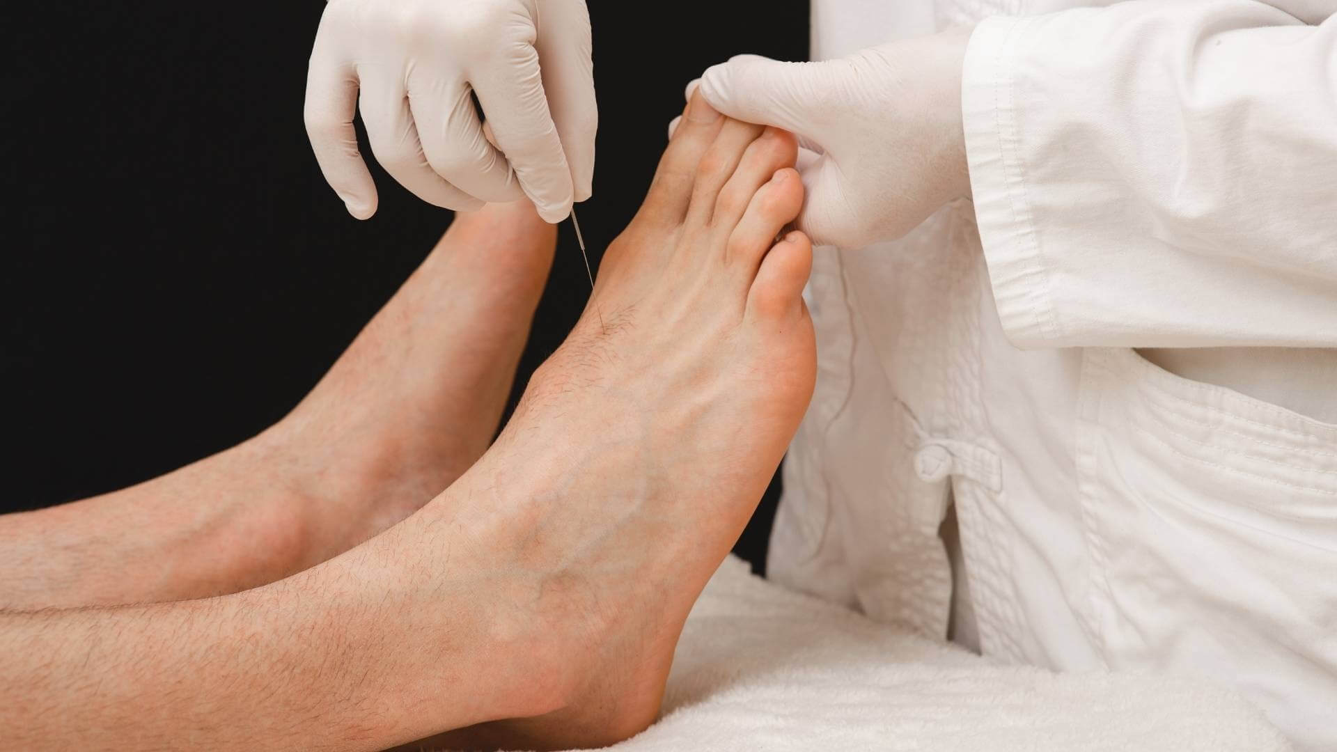 Dry needling vs acupuncture for feet treatment